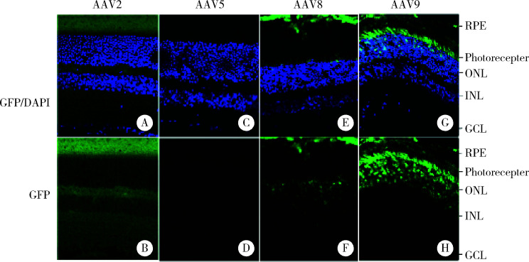 小鼠视网膜下腔注射不同血清型AAV病毒载体后2周的免疫gfp荧光染色